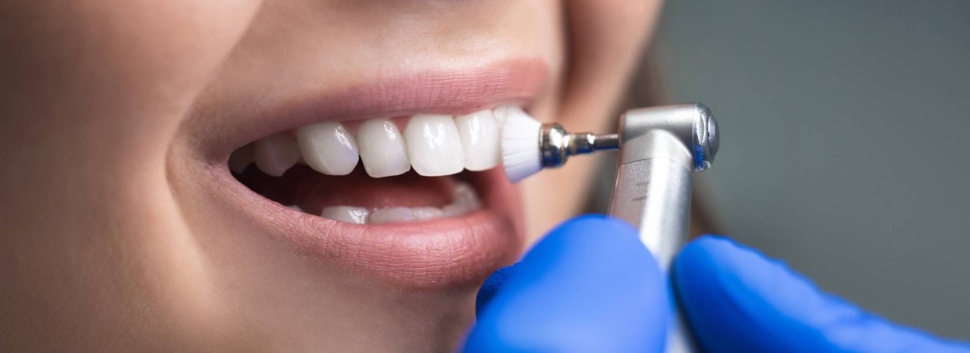 periodontal therapy services